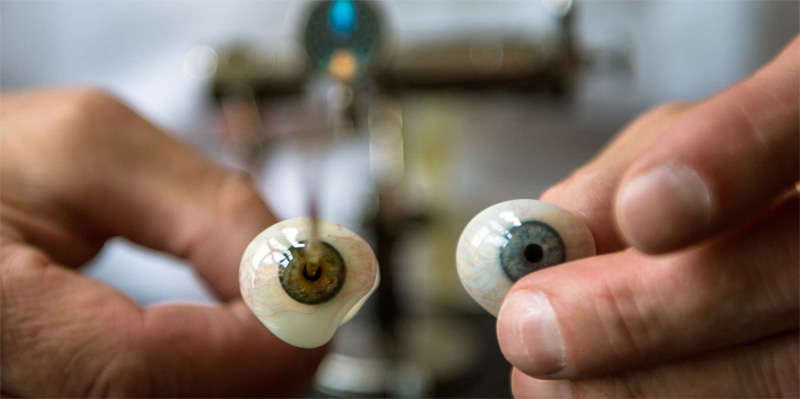 Bionic Eye restore the Function of the Defected Eye