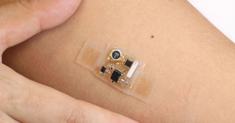Wearable Patch a smart way to disease monitoring and diagnosis