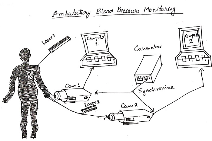 Ambulatory Blood Pressure Monitoring Devices