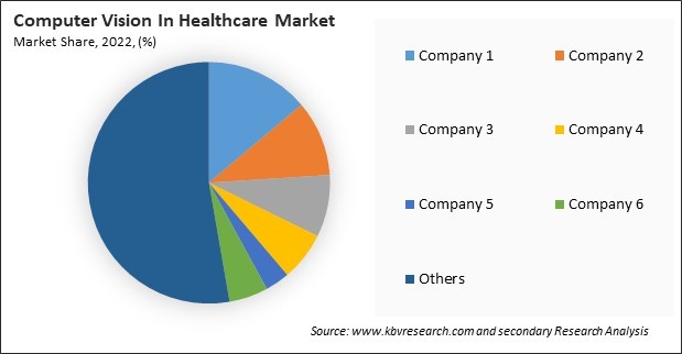 Computer Vision In Healthcare Market Share 2022