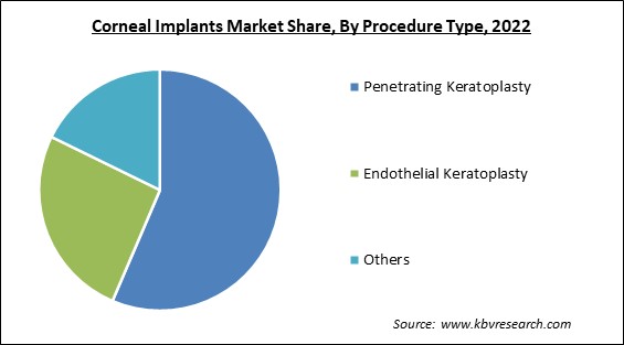 Corneal Implants Market Share and Industry Analysis Report 2022