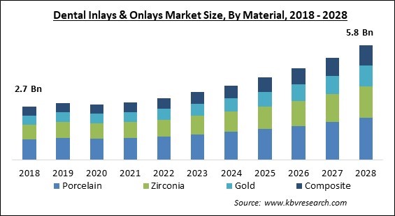 Dental Inlays & Onlays Market - Global Opportunities and Trends Analysis Report 2018-2028
