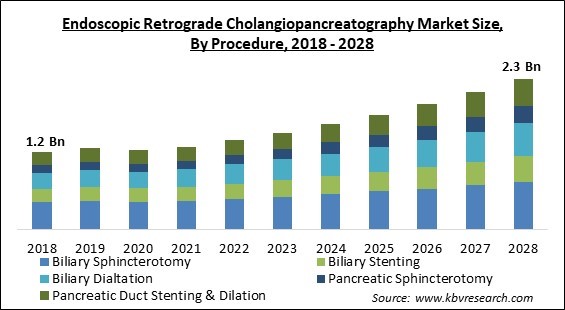 Endoscopic Retrograde Cholangiopancreatography Market Size - Global Opportunities and Trends Analysis Report 2018-2028