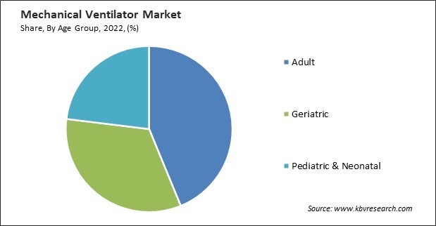 Mechanical Ventilator Market Share and Industry Analysis Report 2020