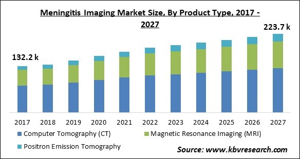 Meningitis Imaging Market Size - Global Opportunities and Trends Analysis Report 2017-2027