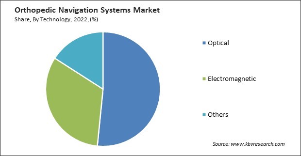 Orthopedic Navigation Systems Market Share and Industry Analysis Report 2022