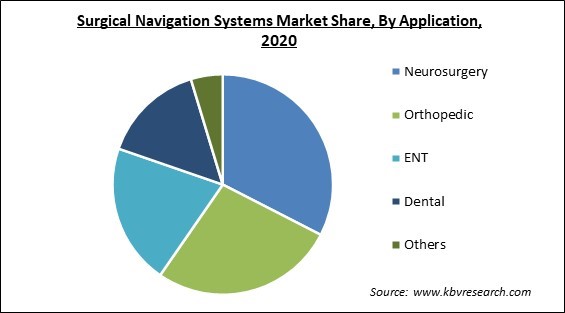 Surgical Navigation Systems Market Share and Industry Analysis Report 2020