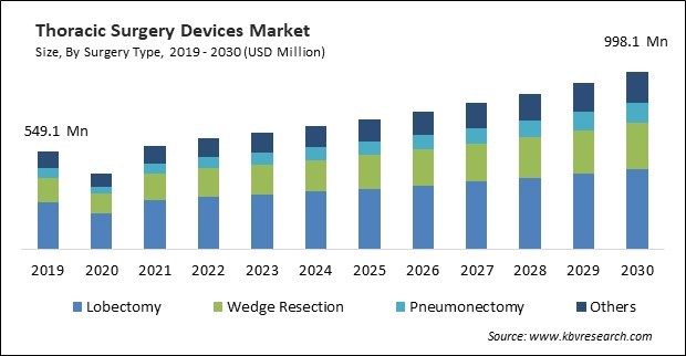 Thoracic Surgery Devices Market Size - Global Opportunities and Trends Analysis Report 2019-2030
