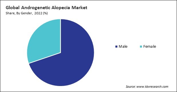 Androgenetic Alopecia Market Share and Industry Analysis Report 2022