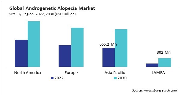 Androgenetic Alopecia Market Size - By Region
