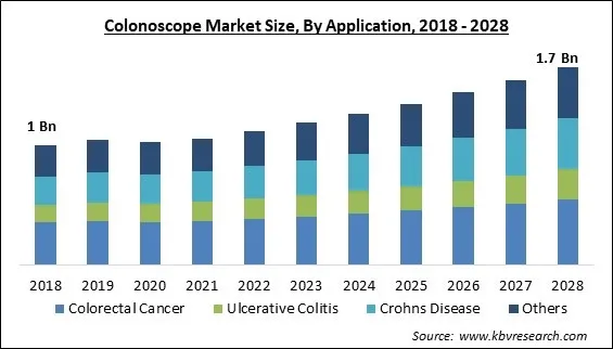 Colonoscope Market Size - Global Opportunities and Trends Analysis Report 2018-2028 Colonoscope Market Size - Global Opportunities and Trends Analysis Report 2018-2028