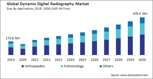 Dynamic Digital Radiography Market Size - Global Opportunities and Trends Analysis Report 2019-2030