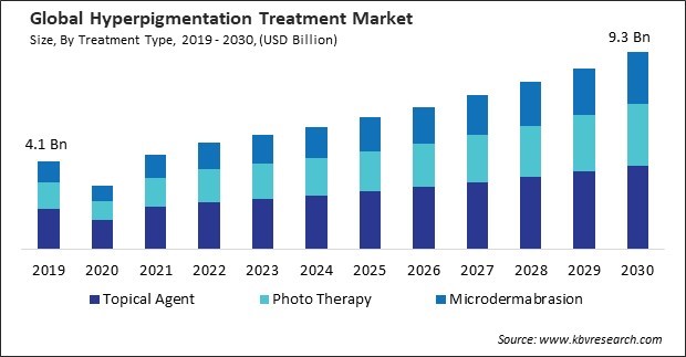 Hyperpigmentation Treatment Market Size - Global Opportunities and Trends Analysis Report 2019-2030