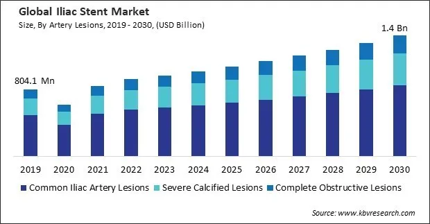 Iliac Stent Market Size - Global Opportunities and Trends Analysis Report 2019-2030