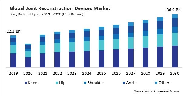 Joint Reconstruction Devices Market Size - Global Opportunities and Trends Analysis Report 2019-2030