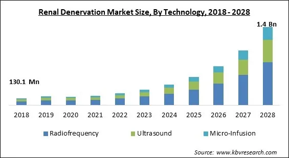 Renal Denervation Market Size - Global Opportunities and Trends Analysis Report 2018-2028 Renal Denervation Market Size - Global Opportunities and Trends Analysis Report 2018-2028