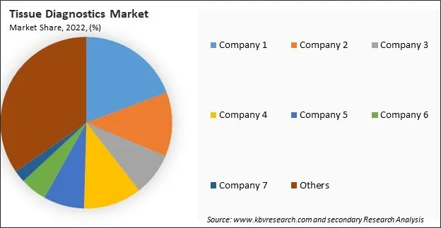 Tissue Diagnostics Market Share 2022