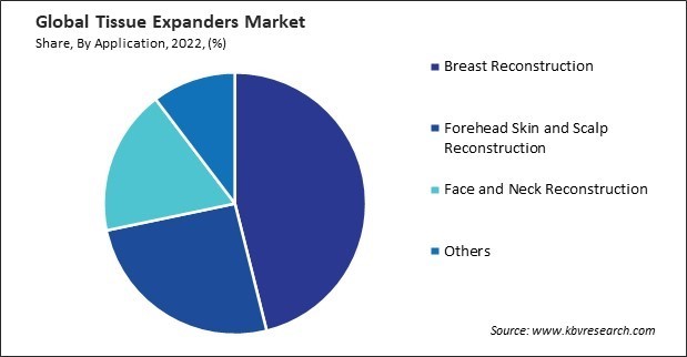 Tissue Expanders Market Share and Industry Analysis Report 2022
